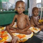 File: Photo of Malnourished children